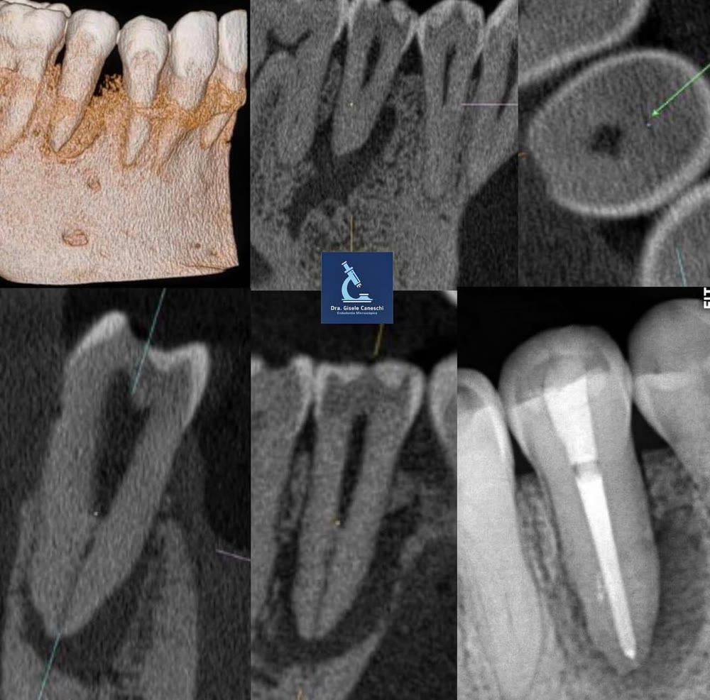 Estudo tomográfico (CBCT) — Dra. Gisele Caneschi